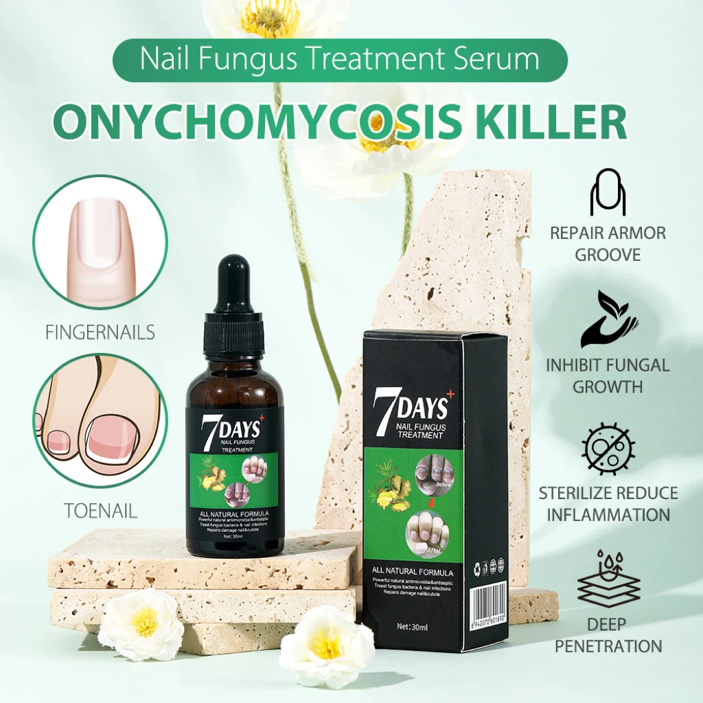 2024 New Arrival 7 Days Nail Fungus Treatment Serum Repairs Damage Nail & cuticle Skin Care Products 30ml Nail Serum