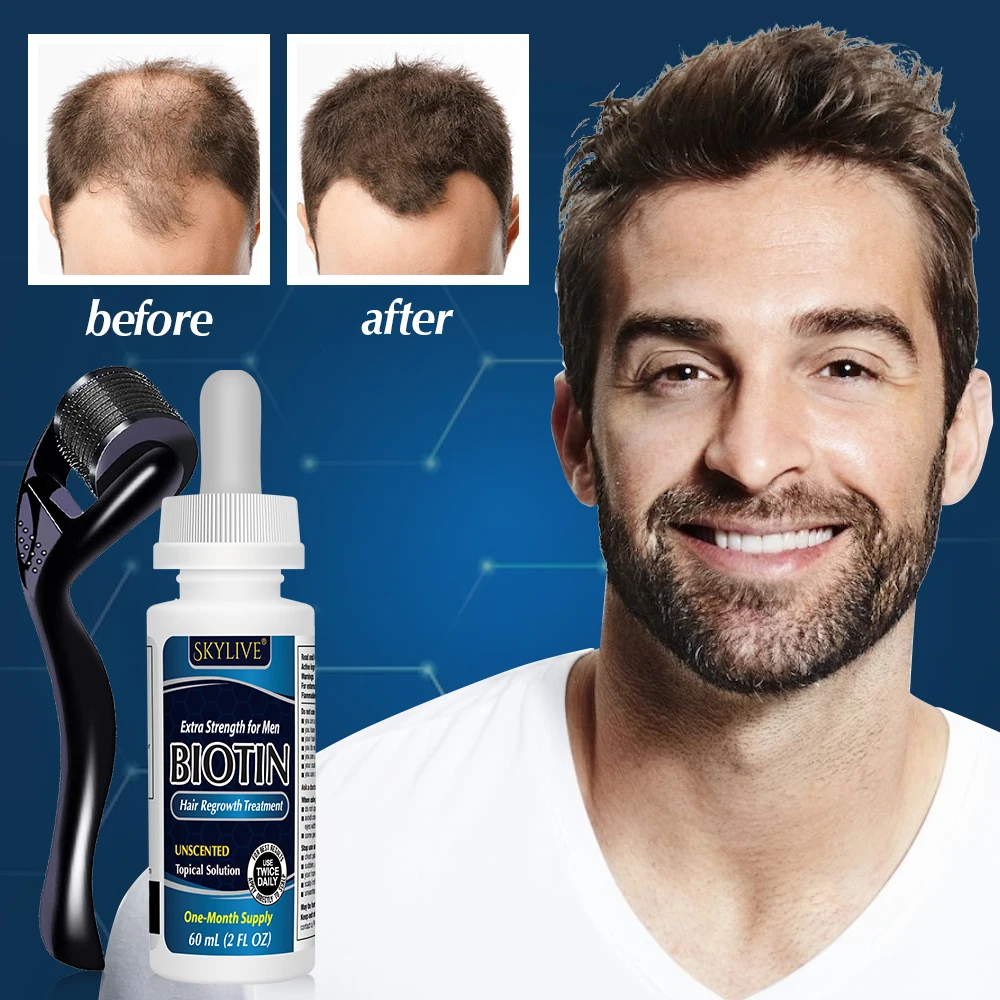 Biotin Hair Growth Serum For Anti Loss Essential Oil Products Fast Treatment Prevent Thinning Dry Frizzy Repair Private Label