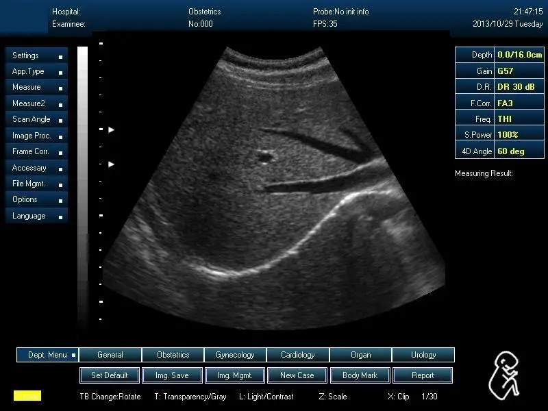 
SUN-800D Cheap price Medical Ultrasound Instruments OB/GYN 3D Ultrasound device 