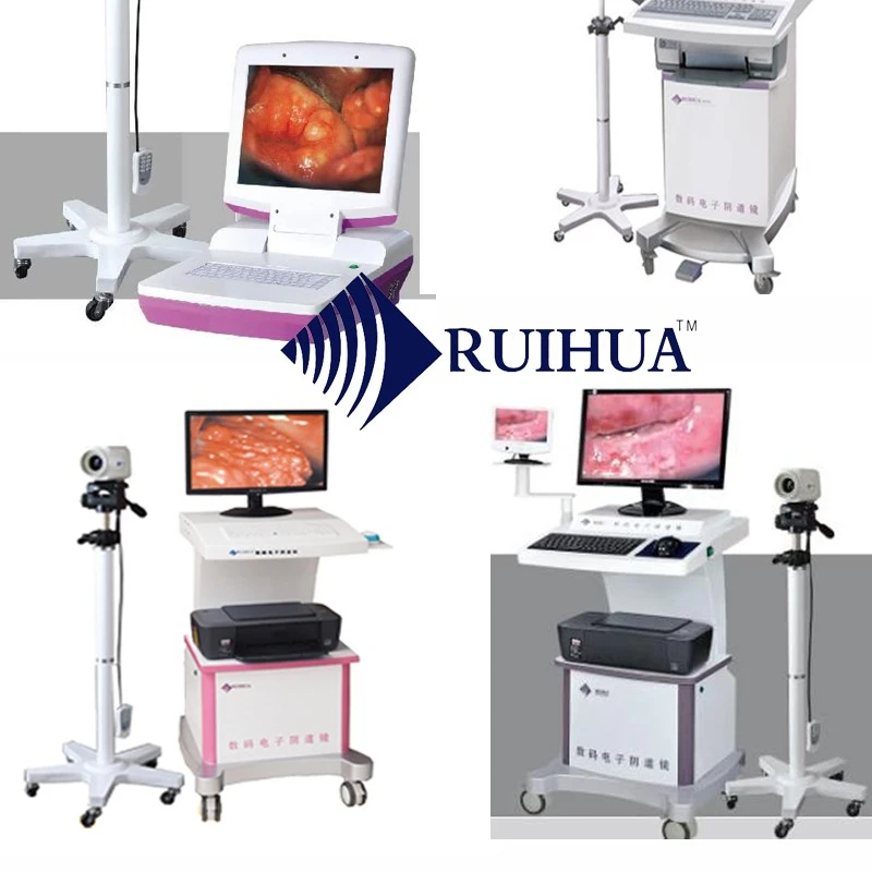 RuiHua brand  manufacturer Digital Electronic Colposcope HD 1080P gynecology