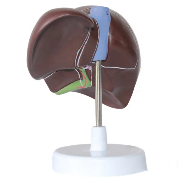 Medical Supplies Human Teaching Liver Pathological Model For School Medical Teaching Display Tool Lab Equipment