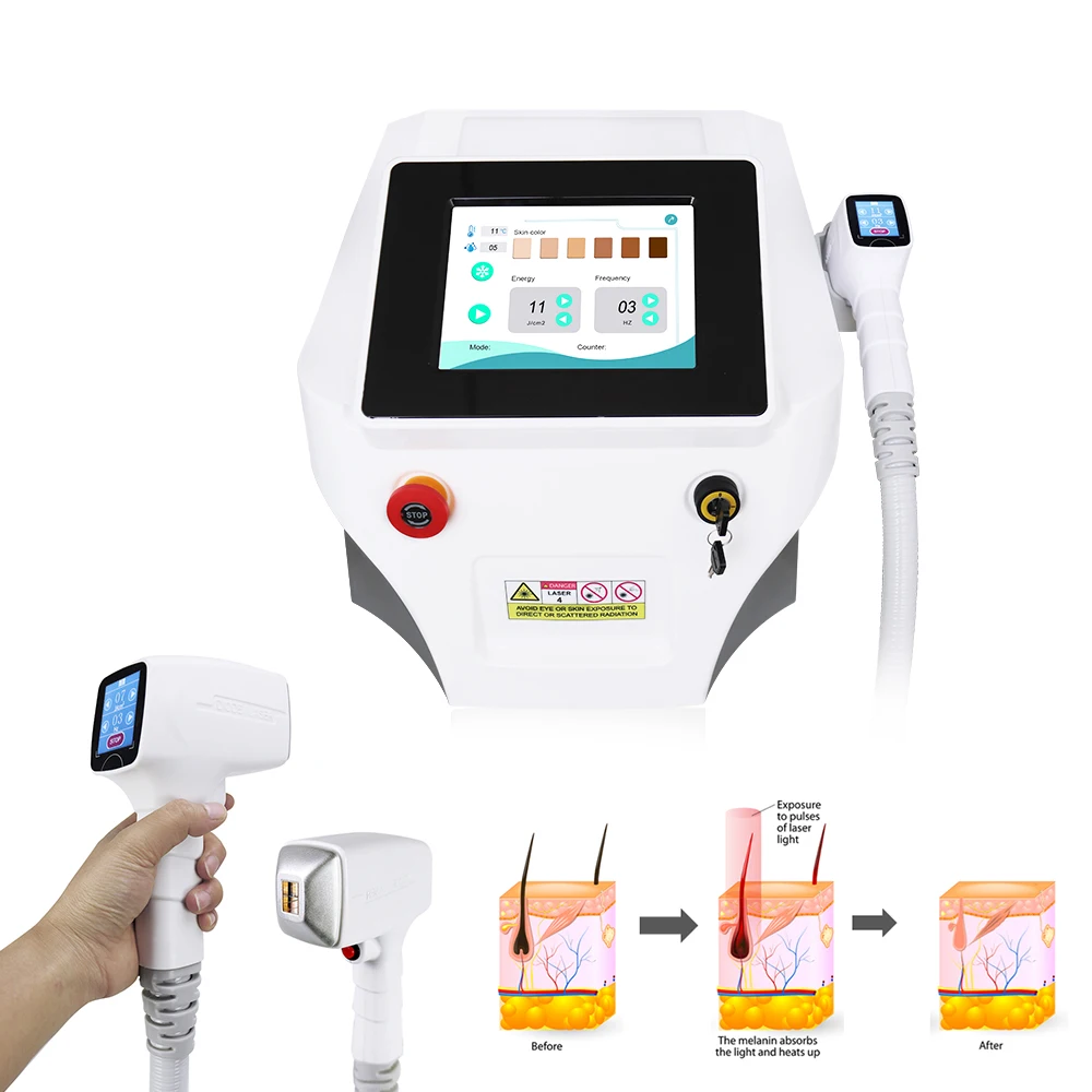 Portable 3 Wave Diode Laser Hair Removal Machine with 755 808 1064 Wave Length Diode Laser 3 Waves Big Spot