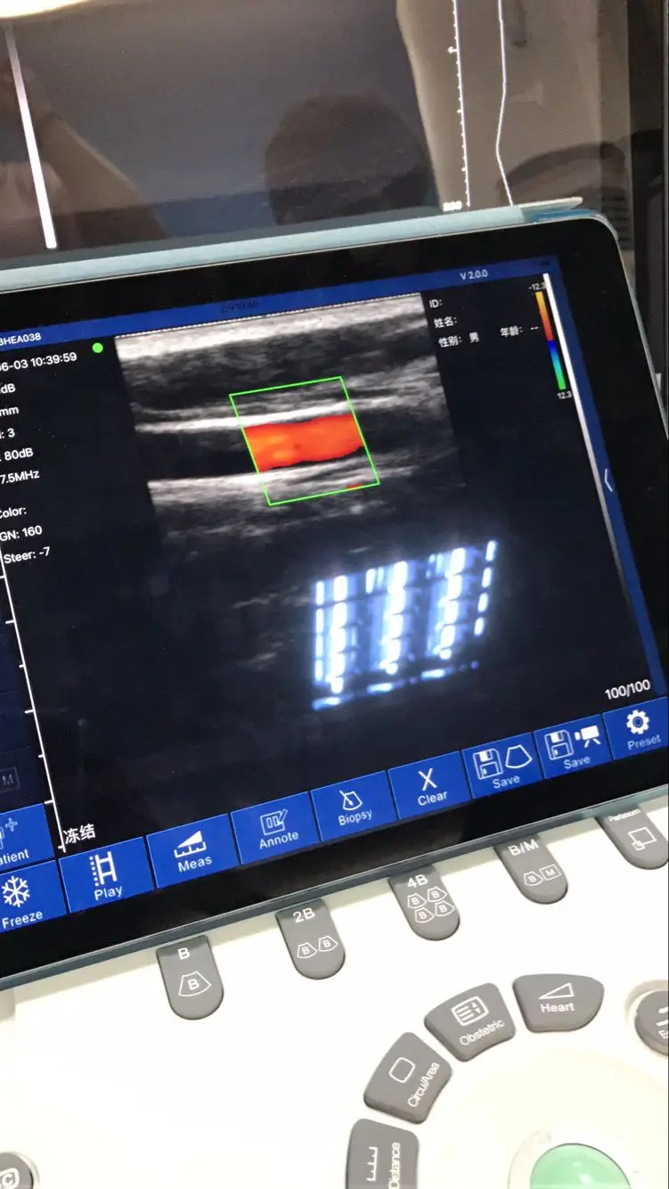 High Quality Wifi Linear Ultrasound Probe  Color Doppler Version Linear Wireless Probe MSLPU55