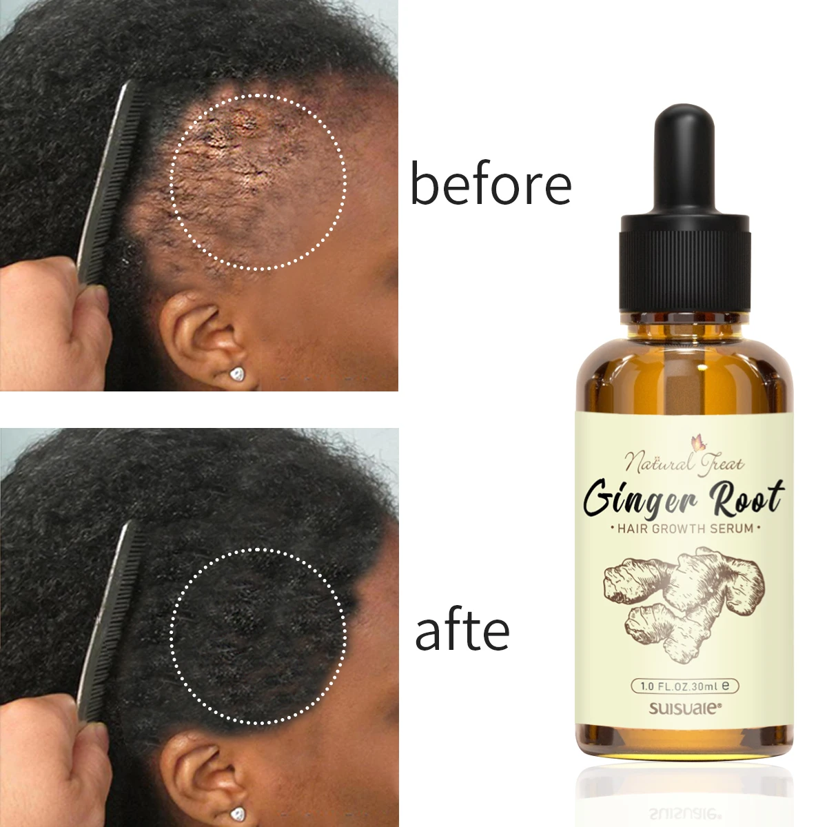 OCCA Private Label 100% Natural Formula Wholesale Nourishing Scalp Elixirs Hair Care Loss Treatment Hair Growth Oil Serum