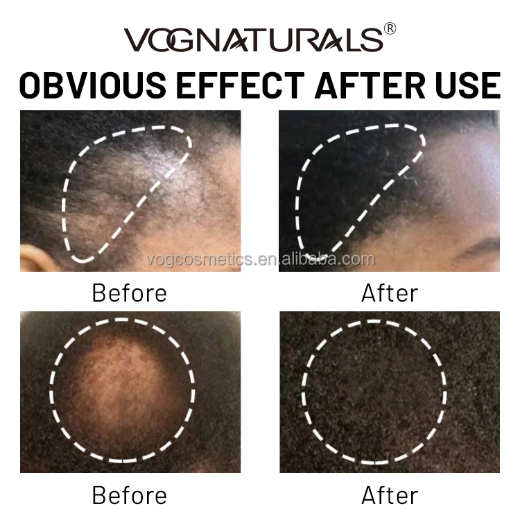 OEM Smoothing Anti Hair Loss Batana Oil For Hair Growth Batana Oil Butter Scalp Treatment Batana Oil Hair Mask