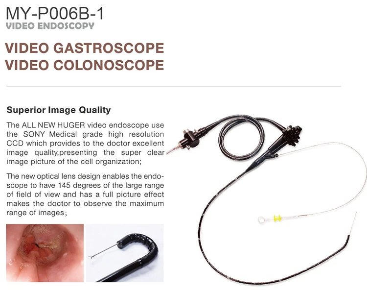  Choledochoscope gynaecology Шрек ent endoscopio чистящие щетки для сотовых телефонов эндоскоп гибочная муфта Урология