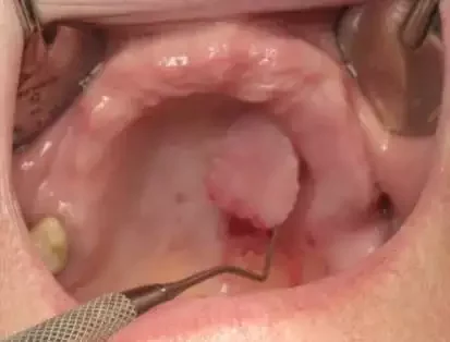 dental 5.png