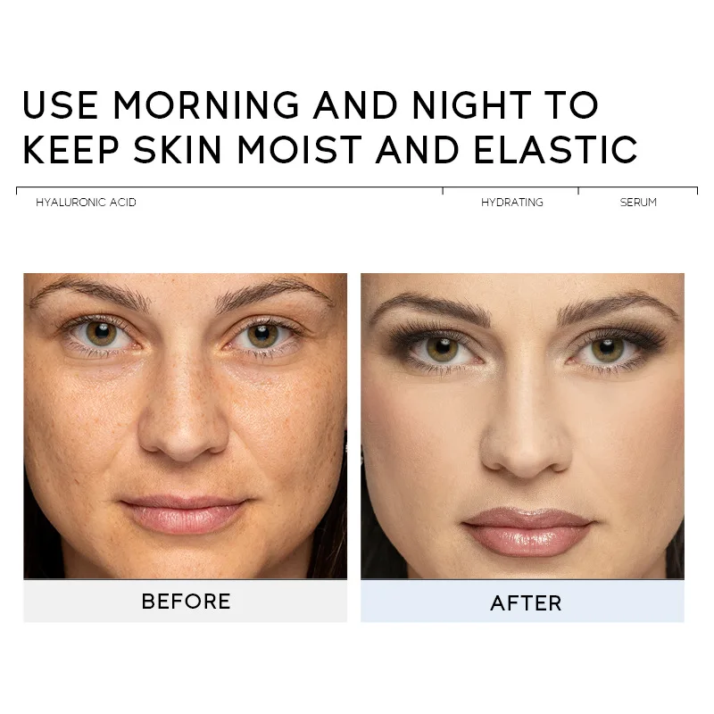 OEM Hyaluronic Acid Facial serum Hydrating, hydrating, firming and brightening Organic ingredients liquid for all skin types