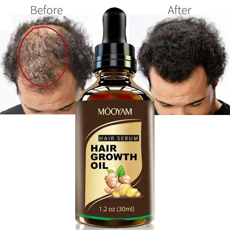 30ml Hair Loss Treatment Growth Oil Natural Hair Growth Essence Organic 7 Days Ginger Germinal Oil for Man Woman