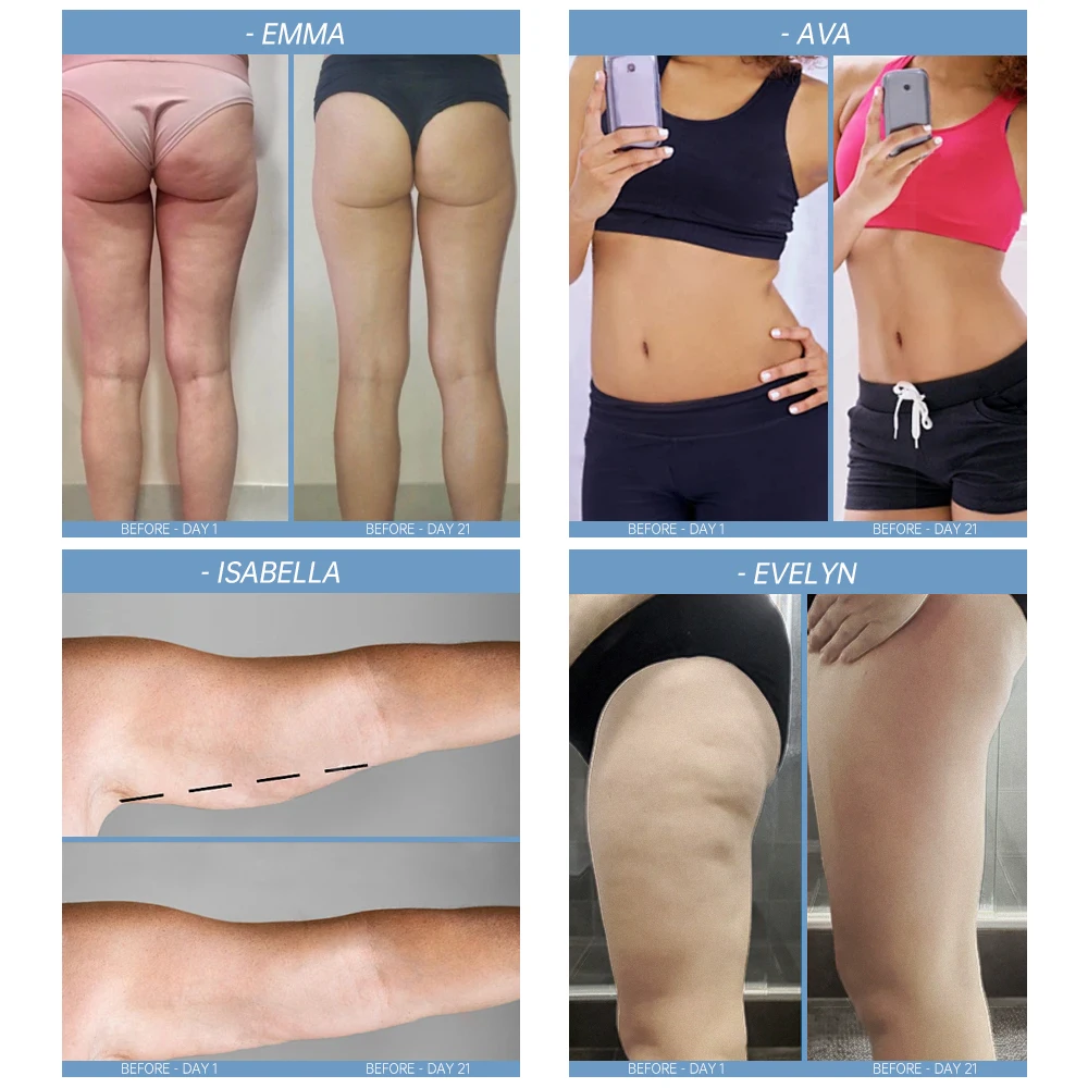 Присоска терапевтический силиконовый роликовый компрессионный массажер для ног