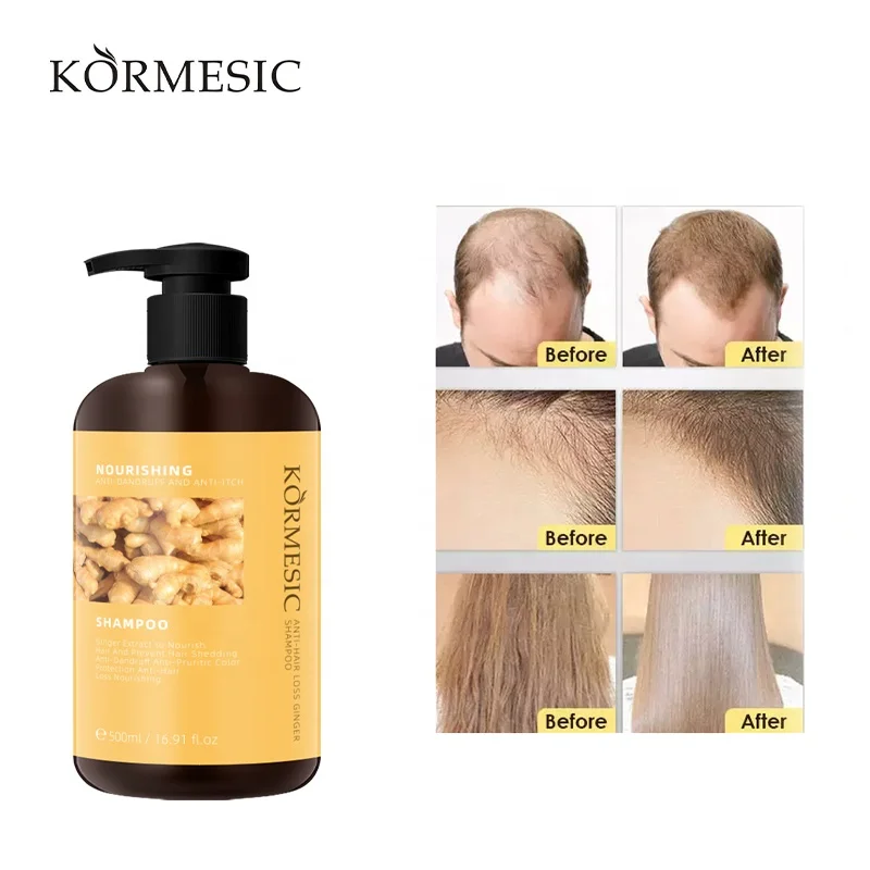 KORMESIC factory 400ml hair care nourishing natural mild organic ginseng shampoo