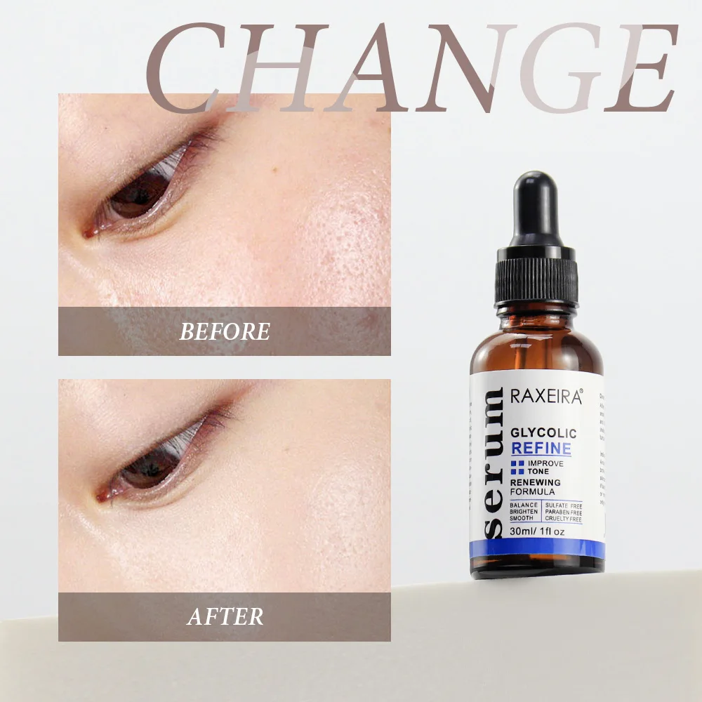 Private Label Chemical Remove Dark Spot Peel Serum for Face Glycolic Acid Serum