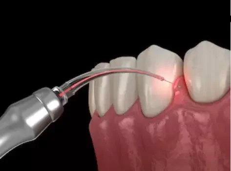 dental 4.png