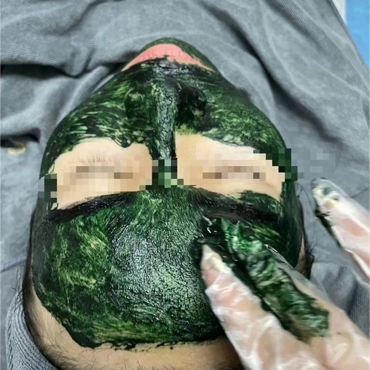 New 5ml Microneedling Really popular Algae Peeling 70% Sponge Spongilla Spicules Powder for Micro Needling Treatment