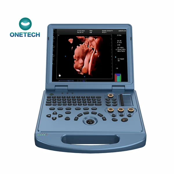 C56 Высокое Качество 4D 5D ультразвуковой аппарат Onetech Цветной Допплер