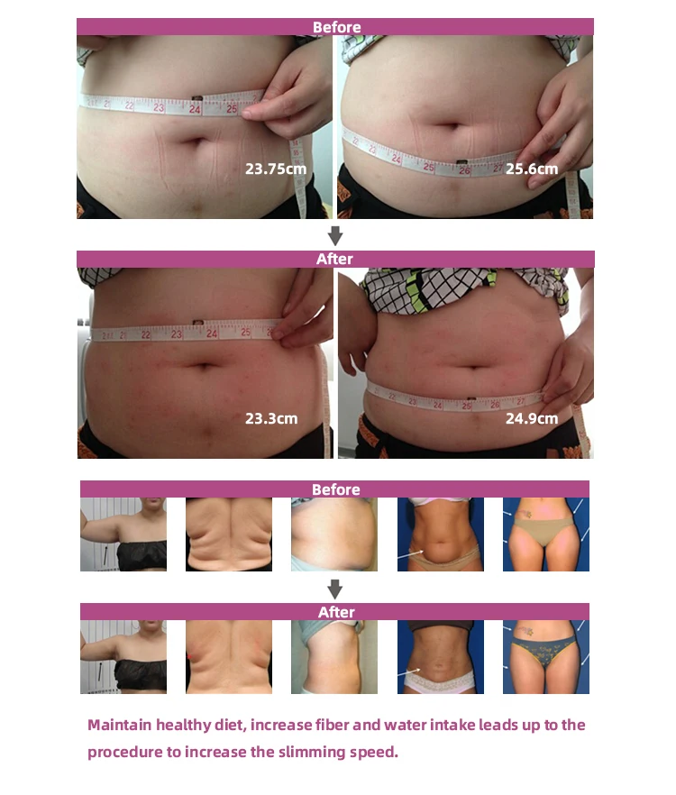 Professional Japanese Laser Diodes lipo Laser Slimming Lipolaser Rapid Slimming Machine