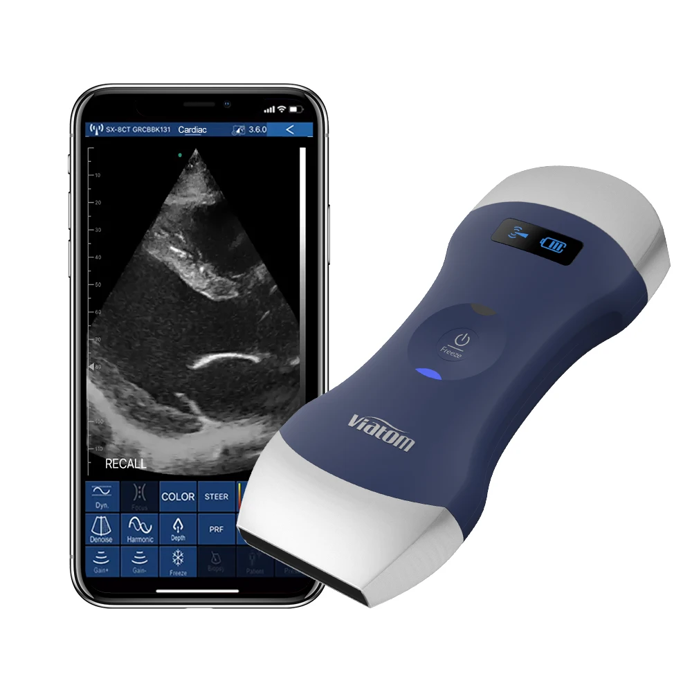 Viatom Portable Ultrasound Wireless Linear/convex 2 Probes 18 Frames High Speed Color Doppler Healthcare Handheld Ultrasound