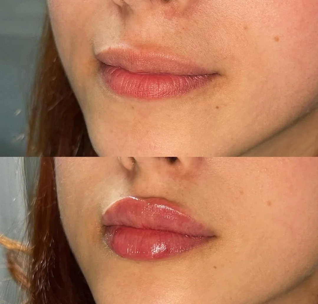 Extreme Hyaluronic Acid 20ml Silver Squeeze Tube Lip Plumper Gloss Custom Logo