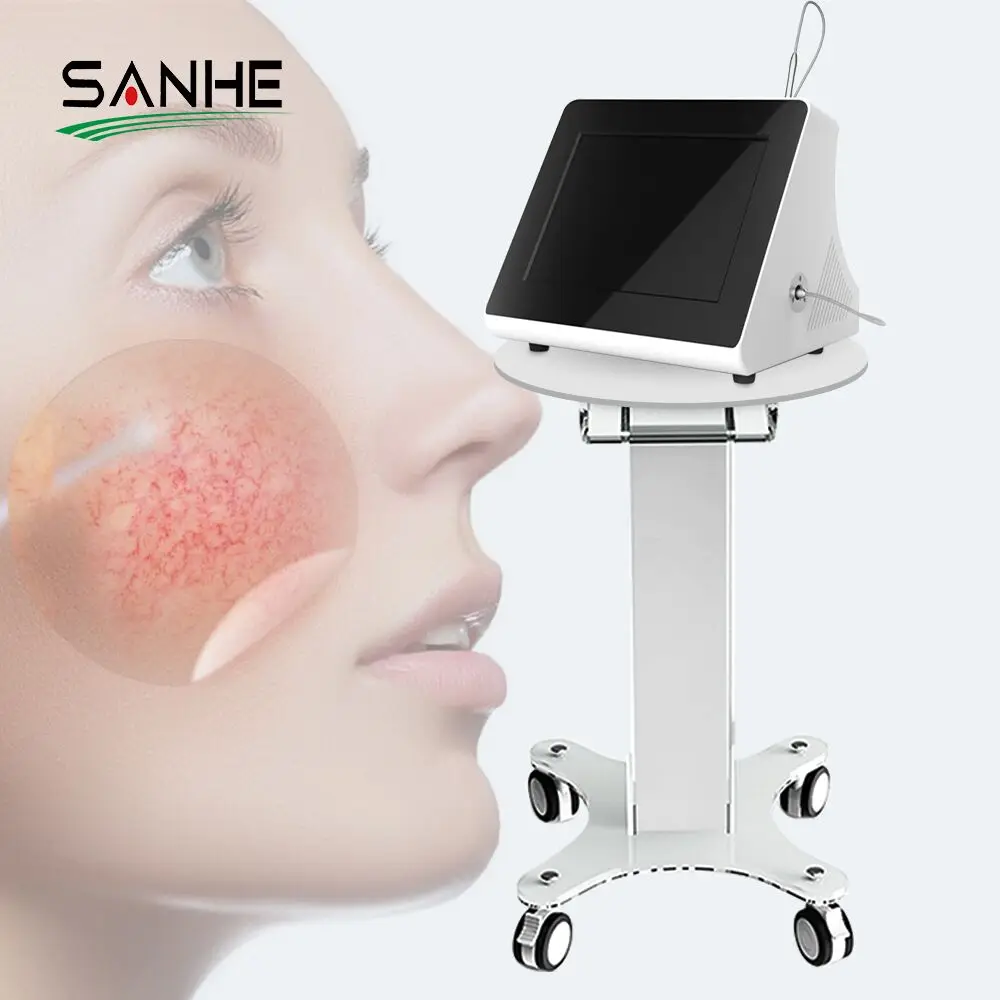 Portable 980 nm Laser Machine for Vascular/Superficial Vein Removal and Rosacea Treatment in Beauty Care