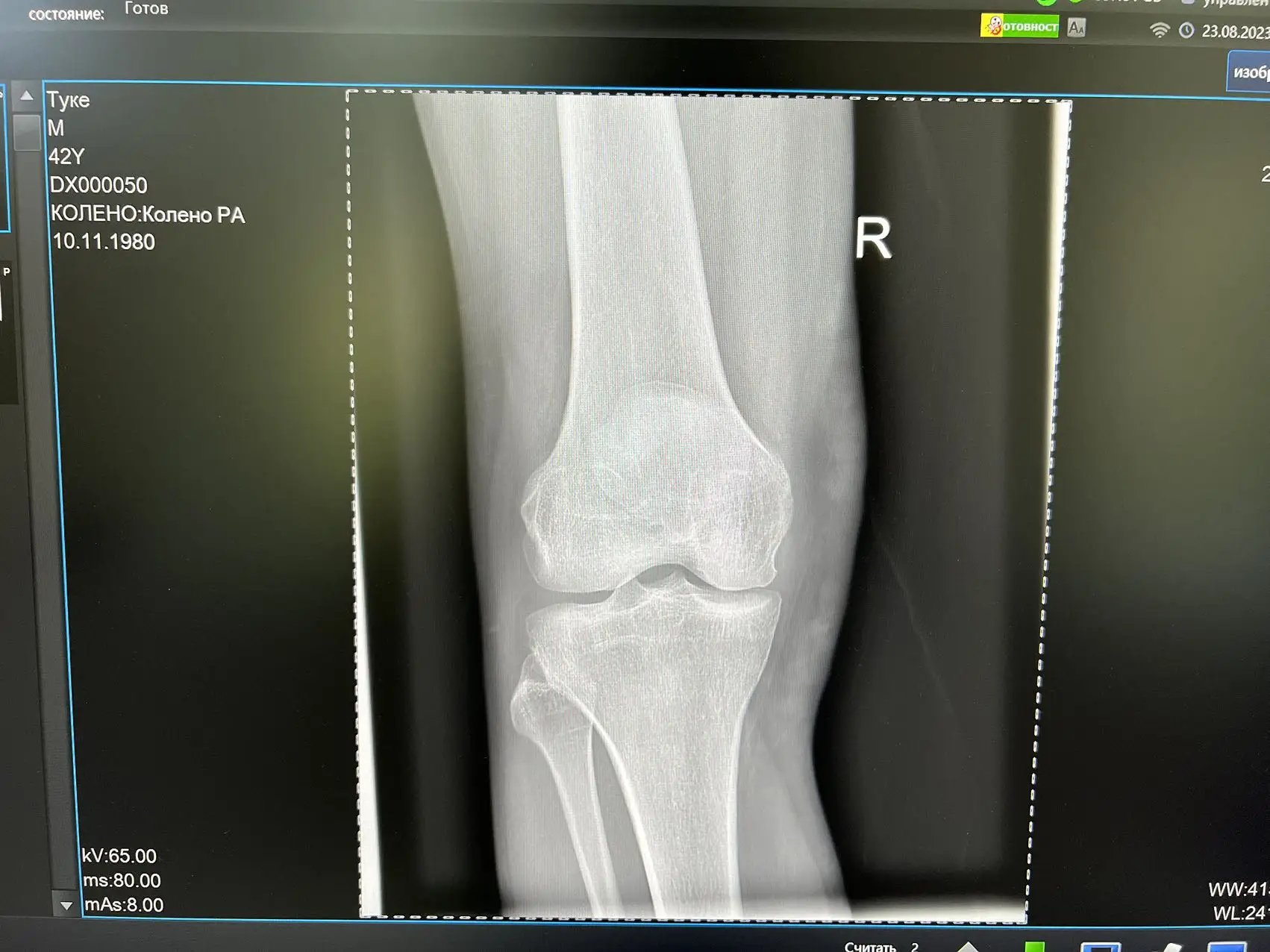 With Wholesale of new products  PLD5600A double column DR System Power supply frequency x-ray medical imaging machine