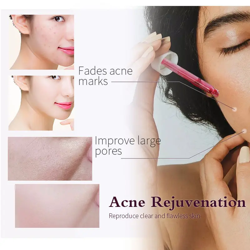 Original Niacinamide 10% Zinc 1% Hyaluronic Acid B5 Alpha Arbutin Buffet Lactic Acid Caffeine Skin Care