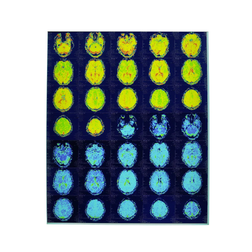 
Class I instrument classification medical radiology film for radiology endoscopic ultrasound 