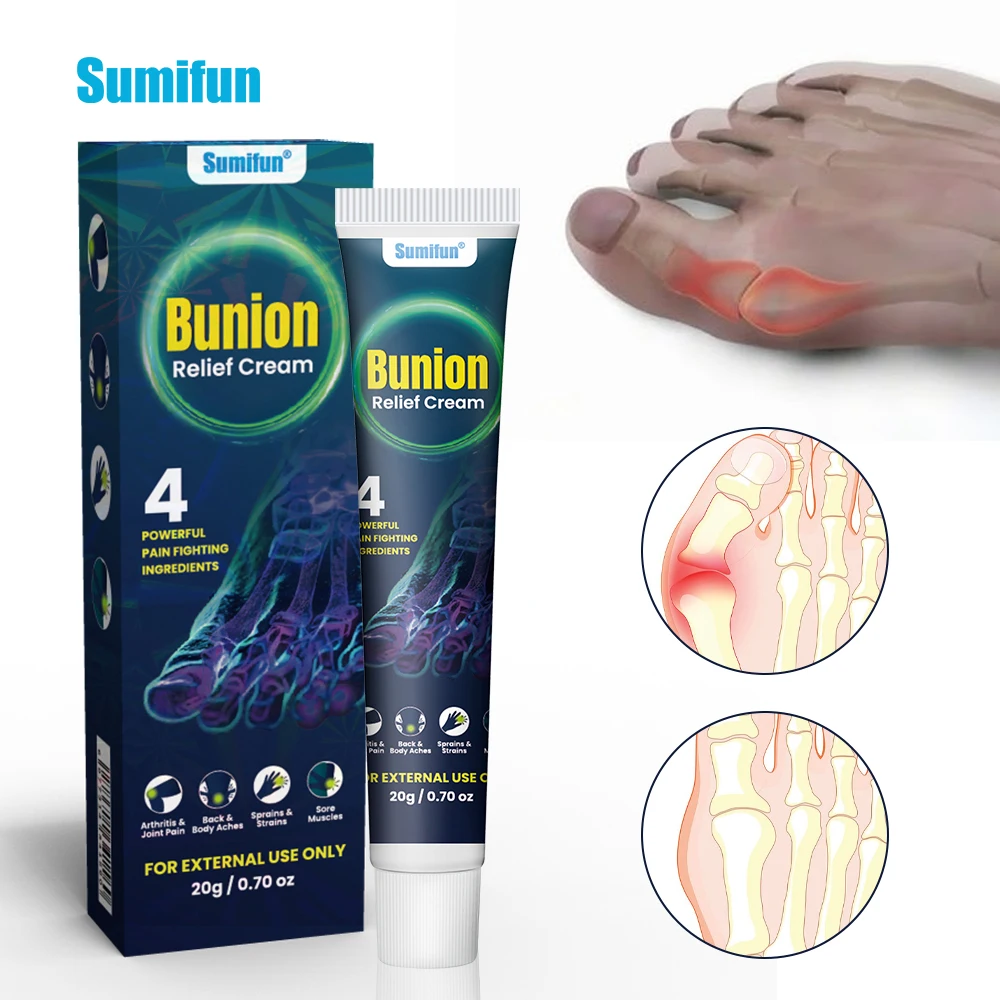 Sumifun Bunion Joint Toe Stiffness Inflammation Treatment Rheumatism Bunion Care Ointment