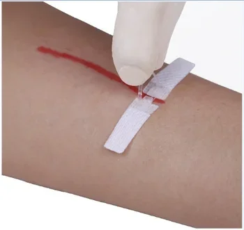 Waterproof local skin wound closure suture sterile strips for hospital use repair wound care skin closure sterile strip