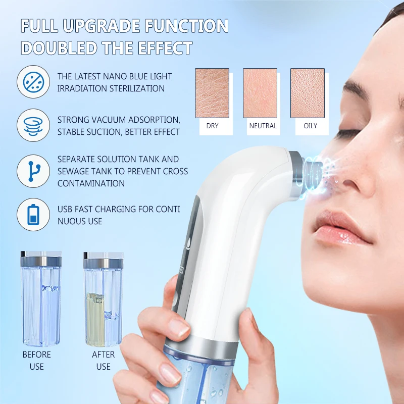 Small Pores Cleaner Bubble Blackhead Remover With Strong Vacuum Suction