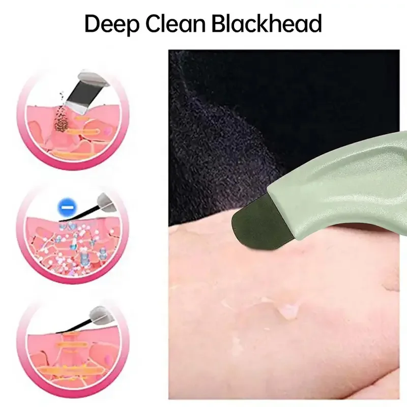 Blackhead Remover Tool Extractor Acne Removal Kit For Blemish, Whitehead Popping, Removing For Nose Face Skin Scrubber Tools Bea