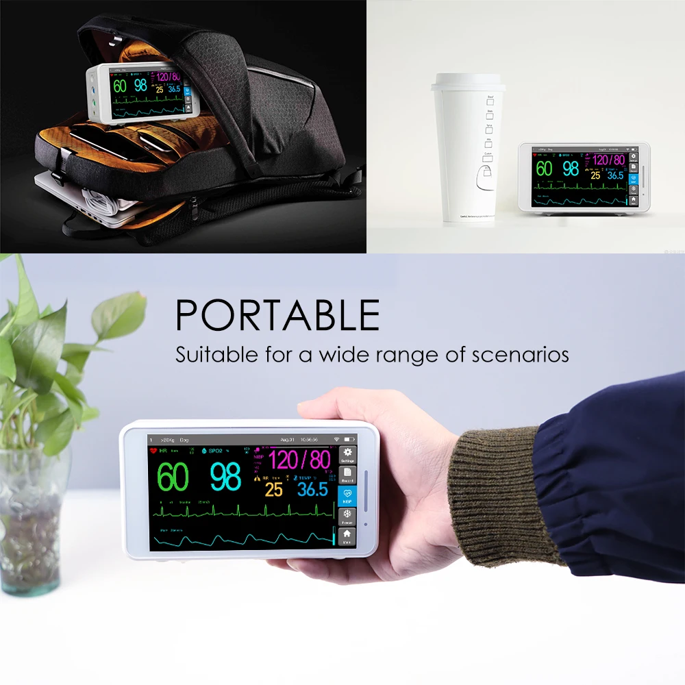 Ветеринарное оборудование монитор жизненно важных признаков артериального давления Ветеринарный пациента