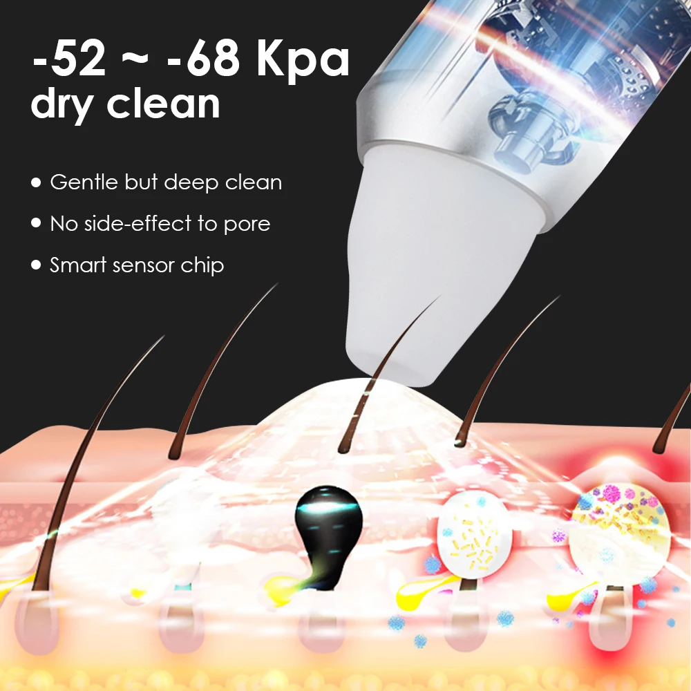 Synogal home use acne treatment brush blemish clearing pore shrinking vacuum blackhead cleaner with camera