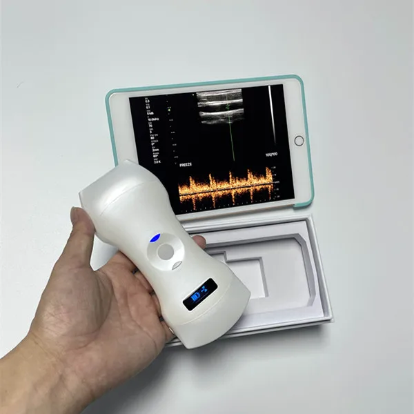 192 elements Color Doppler Ultrasound Wireless Ultrasound Scanner Wireless Double Heads 3 in 1