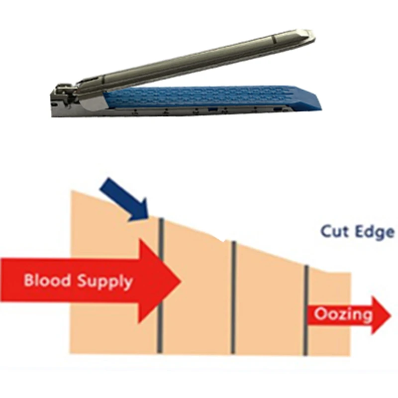 Disposable Laparoscopic Endo Linear Cutter Stapler Cartridge