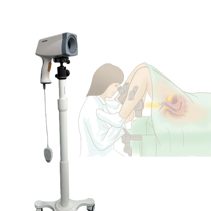 Kernel KN-2200 Hospital Digital Portable Gynecological Colposcope Diagnostic Apparatus Colposcopy Machine For Sale