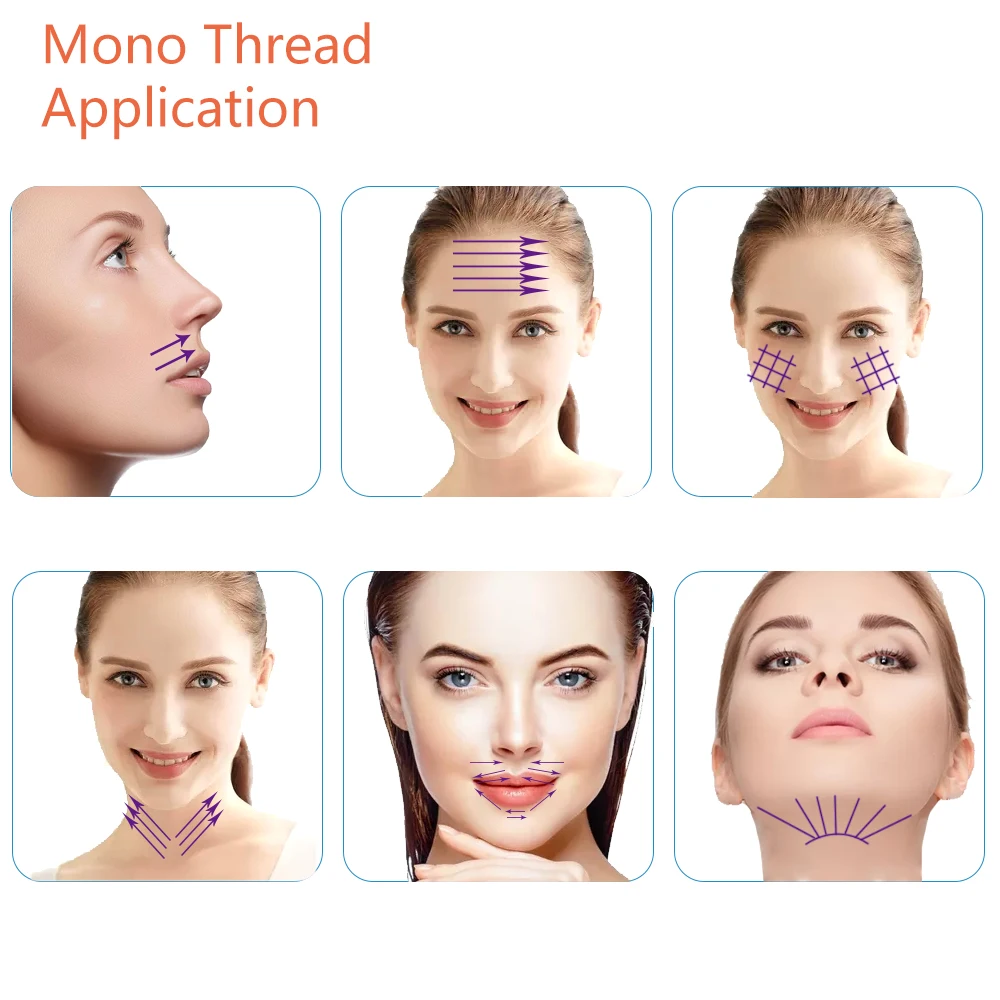 Korea Anti-aging Hilos Tensores Face Lift Mono PDO Thread With Sharp Needle