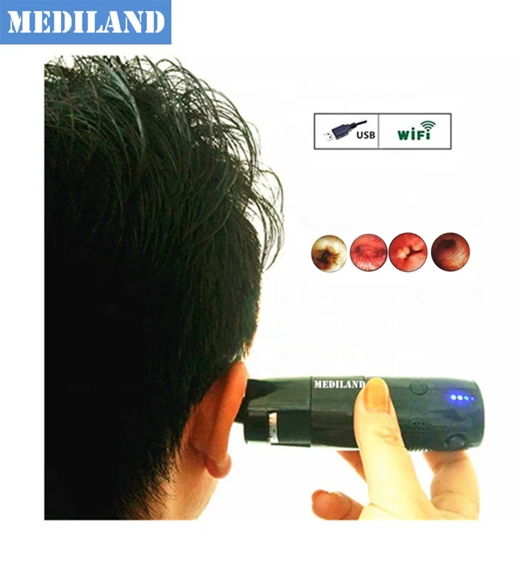 
 ML-402 Wi-Fi цифровой микроскоп с поддержкой IOS/Android/WIndows с HD видео бытовой Wi-Fi отоскоп беспроводной Эндоскоп  