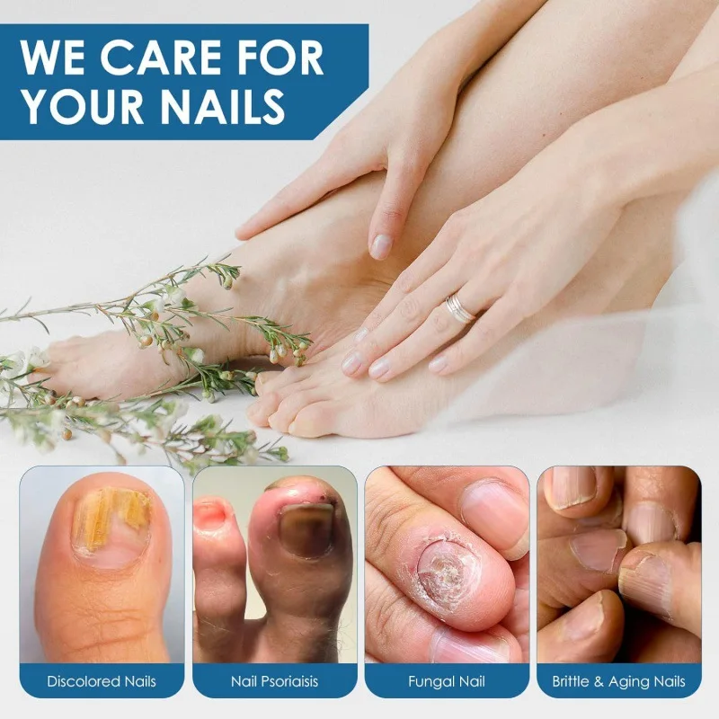 Wholesale of Antibacterial Liquid for Bright Nails Gray Nail Medicine Herbal Antifungal Agent