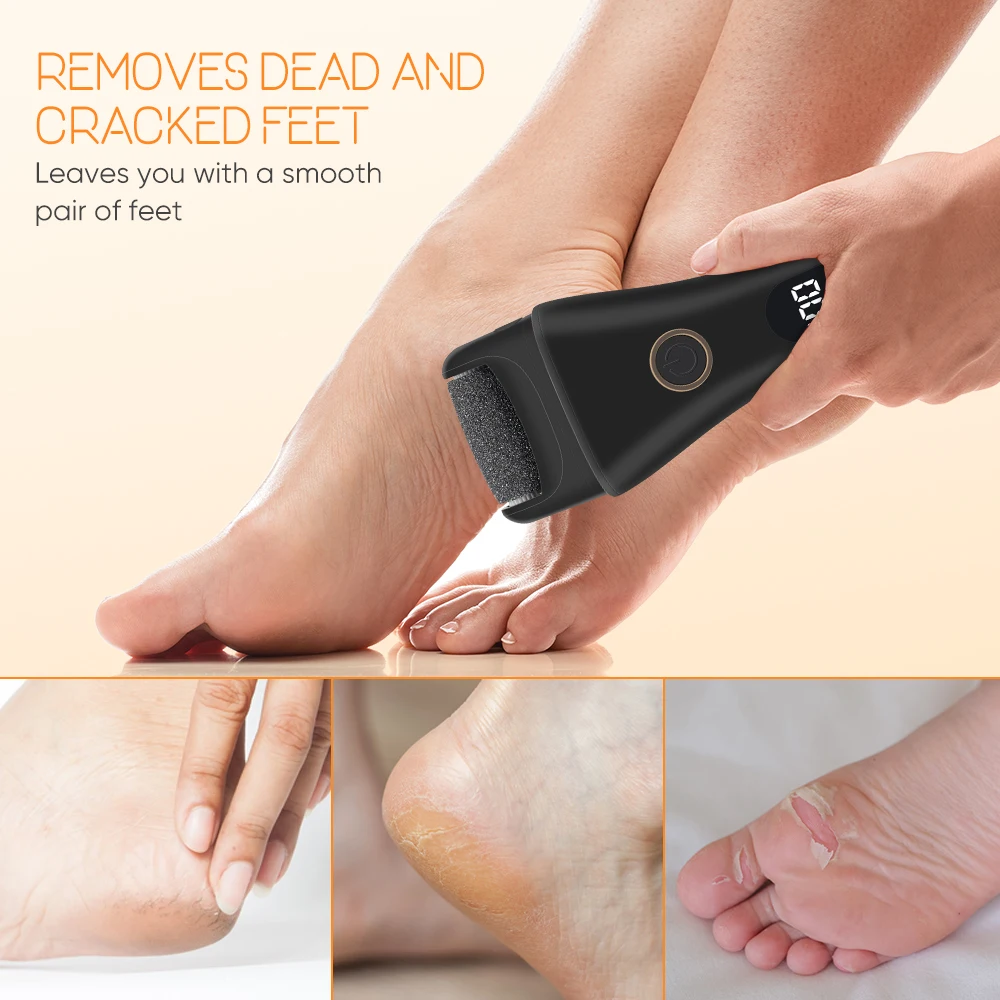 The New Pedicure Manicure Tools  Callus Remover Machine Set Products Foot Care Foot File Callus Remover Foot Skin Care