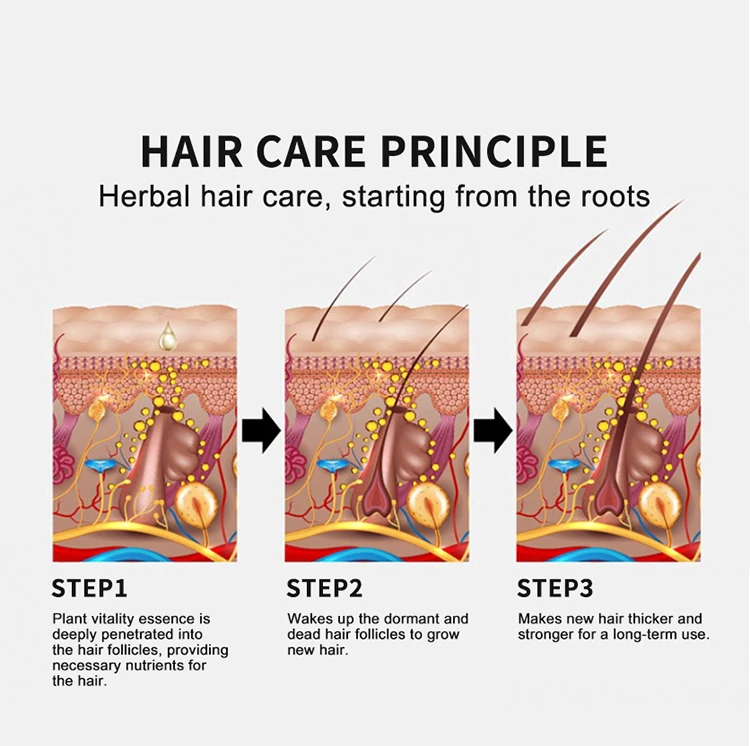 alibaba top 10 wild growth hair oil extreme 7 day beard hair growth oil vendors best oil for hair growth fast effect