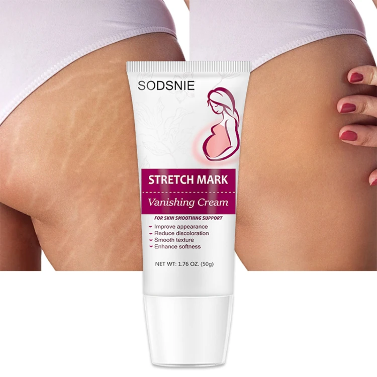 New Arrival Skin Care Pregnancy Slack Anti Stretchmark Scar Repair Body Stretch Marks Removal Cream for Selling