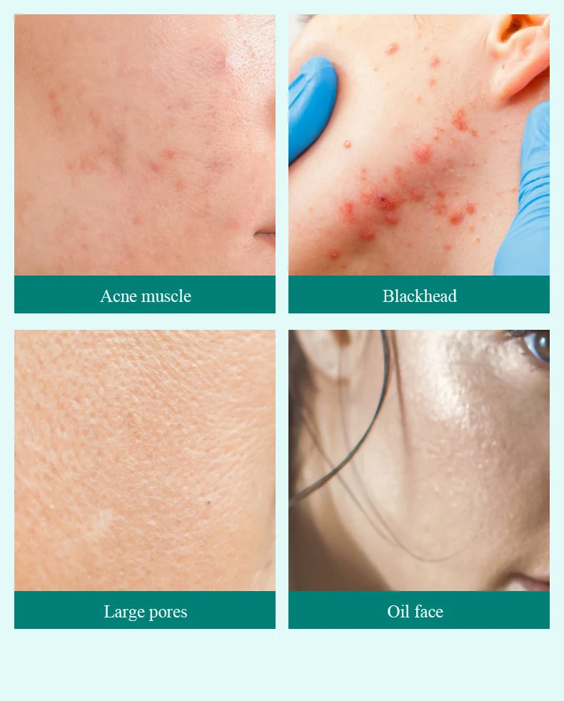 Facial Tool Waterproof Ipx7 Rechargeable Deep Cleaning Face Scrubber Silicone Facial Cleansing Brush