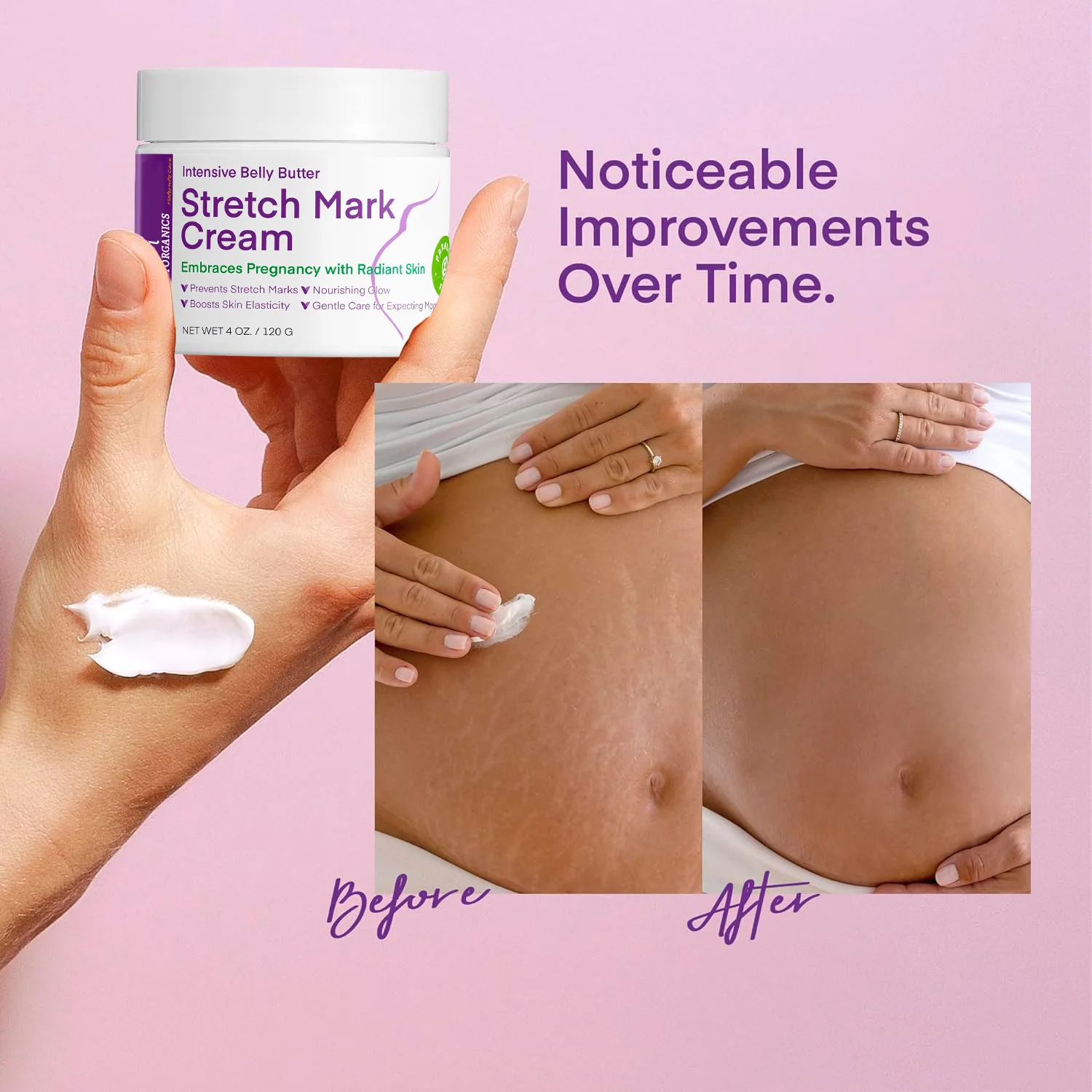 Stretch Mark Cream for Pregnancy Stretch Mark Treatment Belly Butter For Pregnant Massage Lotion Maternity Stretch Marks Scar