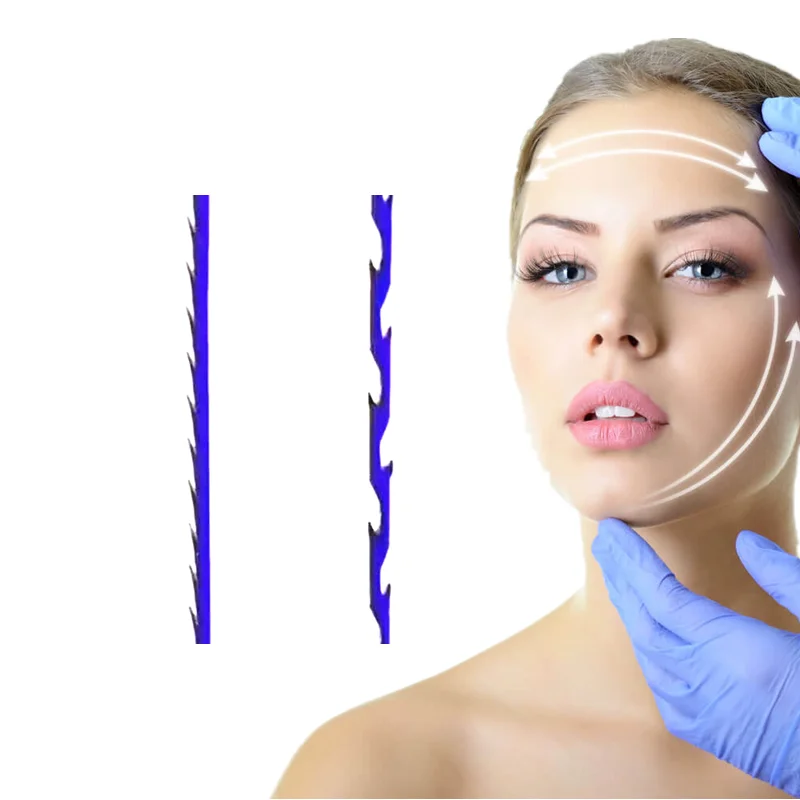 High quality korea Molding Cog 19G 100mm v shaping cosmetic collagen pdo thread for face lift