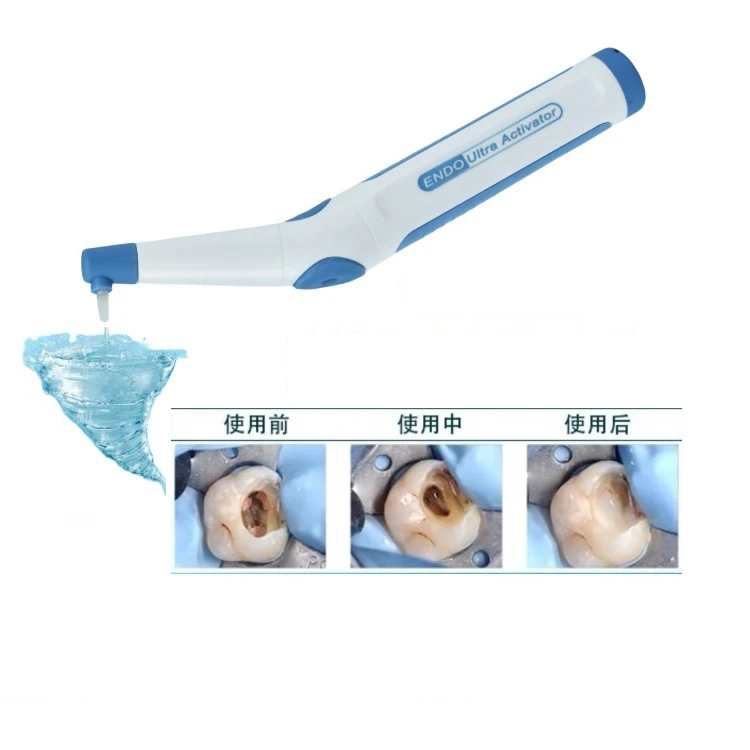 M205 New Root Canal Activator Endo Sonic Irrigator with Free Tips Type C Charging Port Endo Activator Sonic