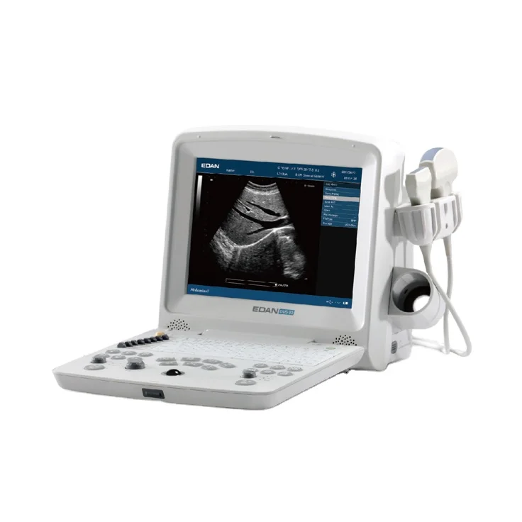 Edan ultrasound machine /ultrasound portable edan dus 60