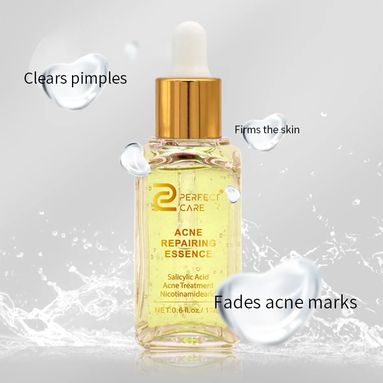 Private Label Againsts Acne And Oil Skin Serum Acne Repairing Essential