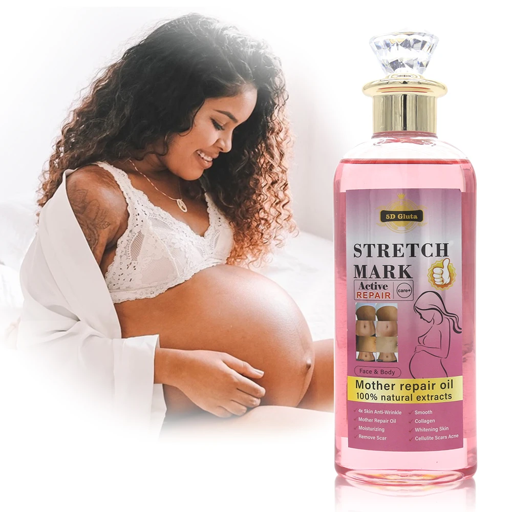 Organic 100% Natural Extracts Stretch Marks Oil Private Label Postpartum Repair Firming Face Body Stretch Mark Remover Oil