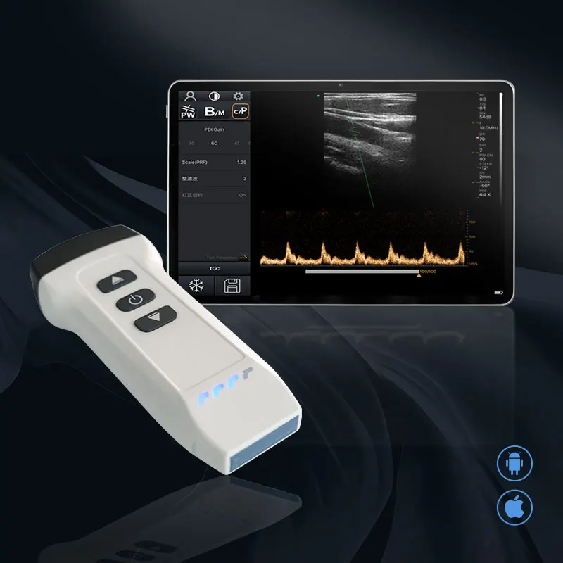 Dawei  DW-X1 wifi wireless handheld color doppler ultrasound machine ultrasound probe