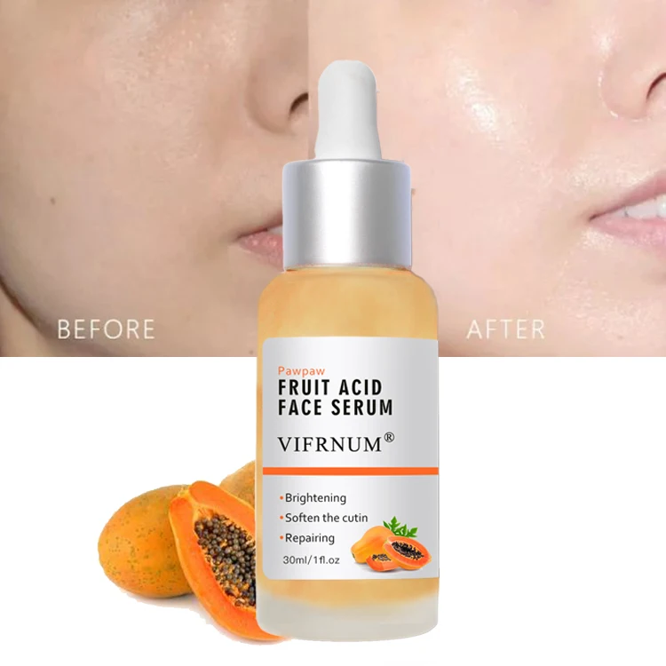 mandelic lactic acid soften the cuticle brightening face serum 3 in 1 aloe vera extract papaya face care serum